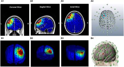 Dose-Response Transcranial Electrical Stimulation Study Design: A Well-Controlled Adaptive Seamless Bayesian Method to Illuminate Negative Valence Role in Tinnitus Perception